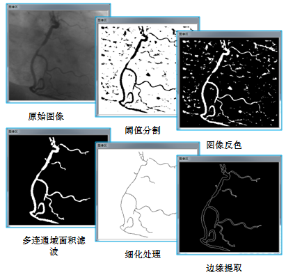 機器視覺的常用術語